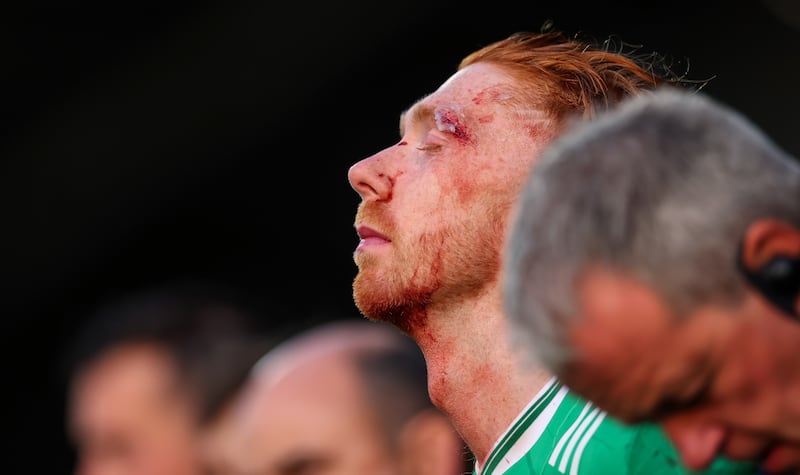 Limerick hurler Cian Lynch at the end of Saturday's thrilling Munster SHC final, which Cork won on penalties. Photograph: James Crombie/Inpho